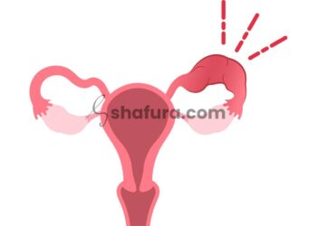 Membongkar Bid’ah dan Menjaga Aqidah: Syarah Aqidah Salaf